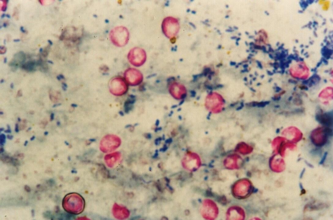 Cryptosporidium